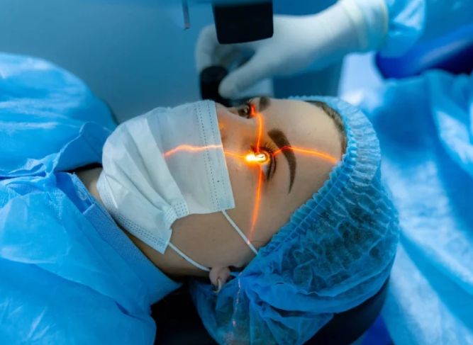 Lasik
